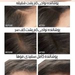استامپ مو - Image 2